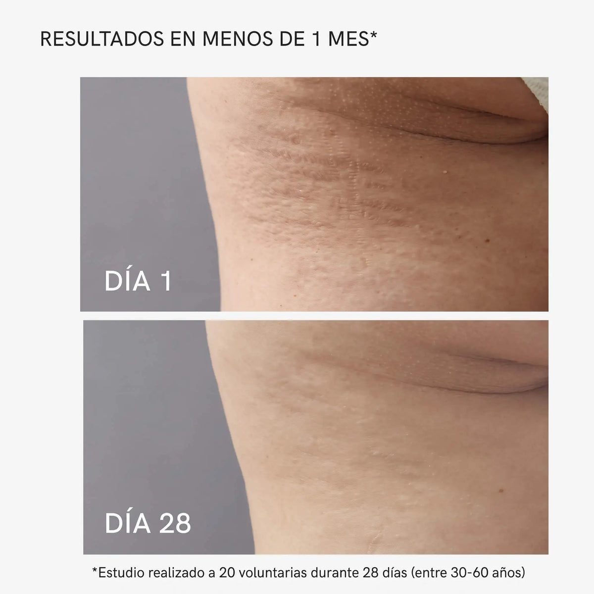Crema Anti celulitis