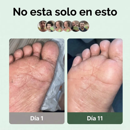 Jabón Antihongos para Pies #1 Adiós Mal Olor